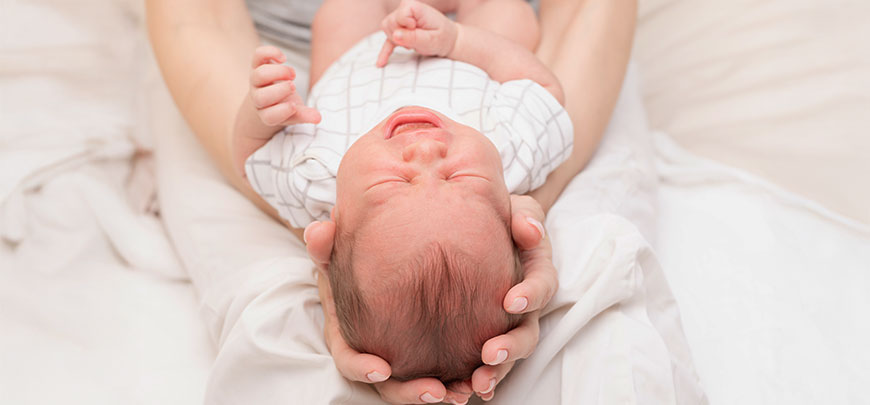 patient needing Plagiocephaly treatment in San Clemente CA