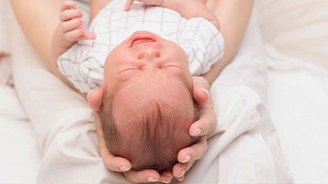 patient requiring plagiocephaly treatment in San Clemente CA